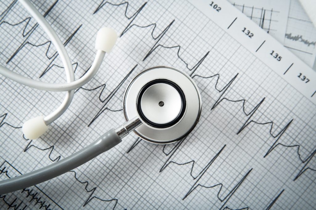 Stethoscope and cardiogram