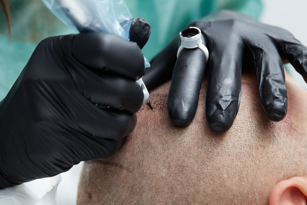 A man with a shaved head getting scalp micro pigmentation treatment in a clinic