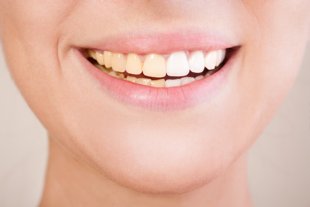 Closeup of a woman smiling and showing her teeth