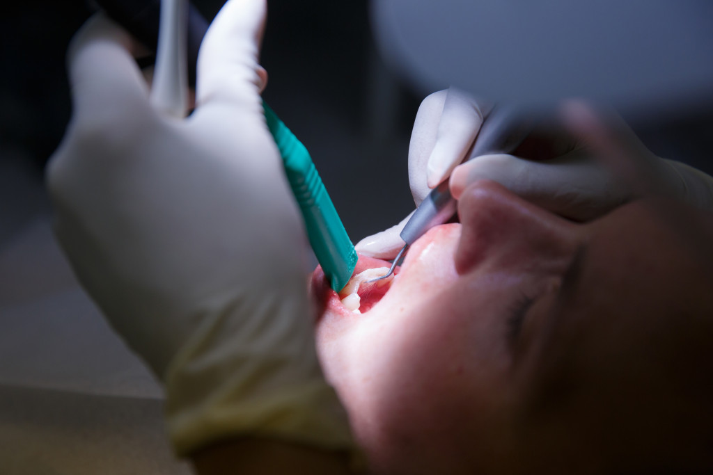 dentist opening a patients mouth for surgery