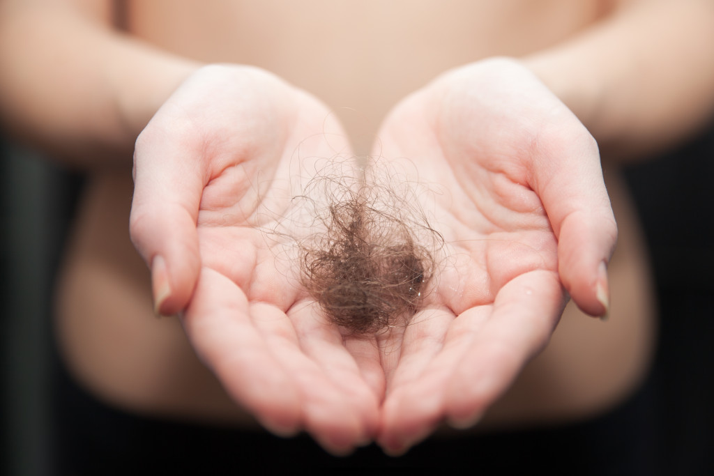 Hair loss in women